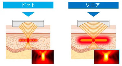 ウルトラセル「Zi」説明